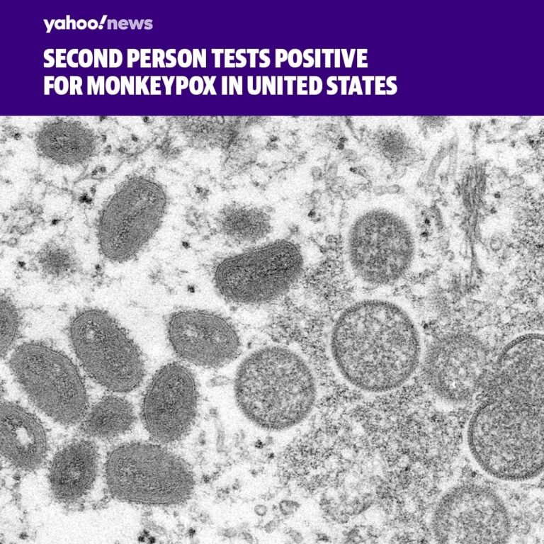 A second person in the United States tested positive for monkeypox Friday, days
